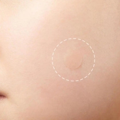 Invisible Removal Pimple Anti-Acne Hydrocolloid Patches
